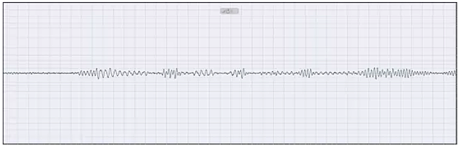 Figure 2 Vortex-shedding signal extracted by the high-resolution interference signal spectrum identification and suppression system flow velocity 0.25 to 1 ms